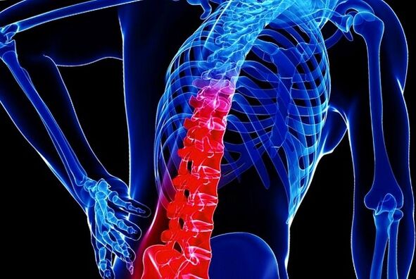 Les raisons du développement de l'ostéochondose toracique