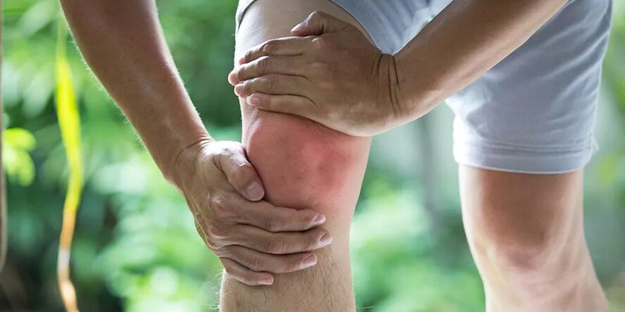 Douleur intense lors d'une activité physique due à une arthrose de l'articulation du genou