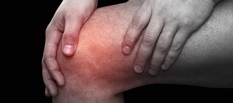 Inflammation et inconfort du genou avec gonarthrose